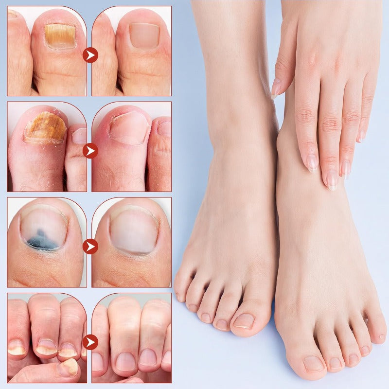 Toenail Repair Extra Strength
