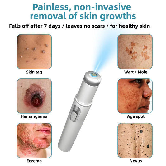 Kidsneed® Non-Invasive Laser Pen | Mole, Wart & Skin Tag Removal Device