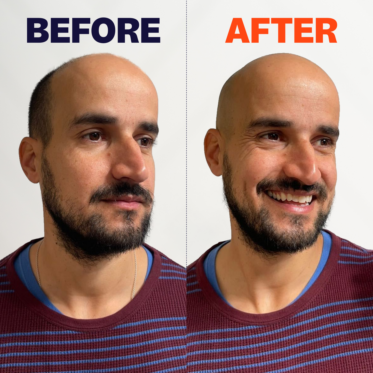 FlexSeries® Shaving Kit - Number 1 in USA !